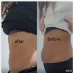 Refit by Aesthetic Line Refit