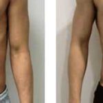 EMS BodyCult - Vorher-Nachher EMS BodyCult - Vorher-Nachher