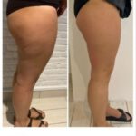 EMS BodyCult - Vorher-Nachher EMS BodyCult - Vorher-Nachher